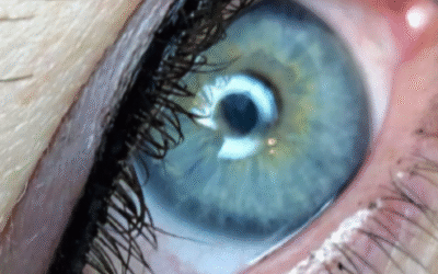 De kracht van pigmentatie